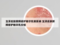玉泽皮肤屏障修护精华乳银屑病 玉泽皮肤屏障修护精华乳价格