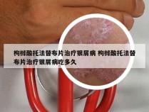 枸橼酸托法替布片治疗银屑病 枸橼酸托法替布片治疗银屑病吃多久