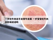 一岁吃牛肉会不会得牛皮癣 一岁宝宝吃牛肉会影响说话吗