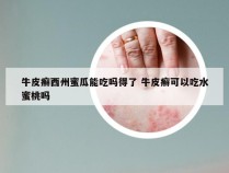 牛皮癣西州蜜瓜能吃吗得了 牛皮癣可以吃水蜜桃吗