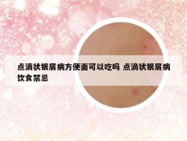 点滴状银屑病方便面可以吃吗 点滴状银屑病饮食禁忌