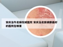安庆治牛皮癣权威医院 安庆治皮肤病那最好的医院在哪里