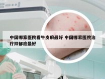 中国哪家医院看牛皮癣最好 中国哪家医院治疗抑郁症最好