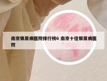 南京银屑病医院排行榜6 南京十佳银屑病医院