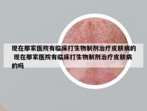 现在那家医院有临床打生物制剂治疗皮肤病的 现在那家医院有临床打生物制剂治疗皮肤病的吗