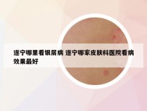 遂宁哪里看银屑病 遂宁哪家皮肤科医院看病效果最好