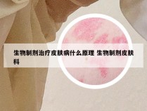 生物制剂治疗皮肤病什么原理 生物制剂皮肤科