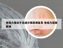免疫力强会不会减少银屑病复发 免疫力低银屑病