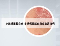 小孩嘴里起白点 小孩嘴里起白点点会高烧吗