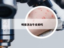 喝姜汤治牛皮癣吗
