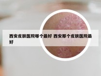 西安皮肤医院哪个最好 西安那个皮肤医院最好