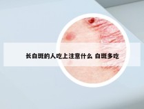 长白斑的人吃上注意什么 白斑多吃