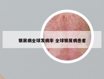 银屑病全球发病率 全球银屑病患者