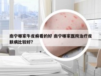 南宁哪家牛皮癣看的好 南宁哪家医院治疗皮肤病比较好?