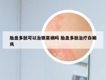 胎盘多肽可以治银屑病吗 胎盘多肽治疗白癜风