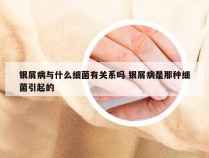 银屑病与什么细菌有关系吗 银屑病是那种细菌引起的