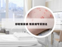 郑敏银屑病 银屑病专家排名