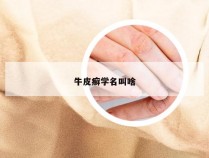 牛皮癣学名叫啥