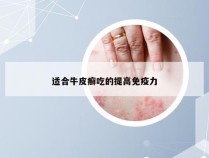 适合牛皮癣吃的提高免疫力