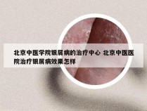 北京中医学院银屑病的治疗中心 北京中医医院治疗银屑病效果怎样