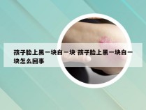 孩子脸上黑一块白一块 孩子脸上黑一块白一块怎么回事