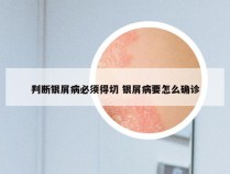 判断银屑病必须得切 银屑病要怎么确诊