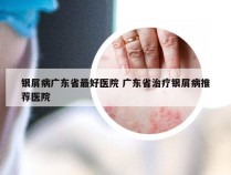 银屑病广东省最好医院 广东省治疗银屑病推荐医院