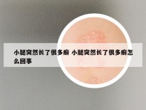 小腿突然长了很多癣 小腿突然长了很多癣怎么回事