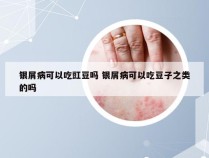 银屑病可以吃豇豆吗 银屑病可以吃豆子之类的吗