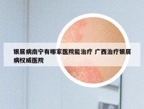 银屑病南宁有哪家医院能治疗 广西治疗银屑病权威医院