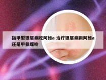 指甲型银屑病吃阿维a 治疗银屑病用阿维a还是甲氨蝶呤