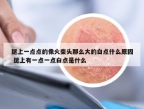 腿上一点点的像火柴头那么大的白点什么原因 腿上有一点一点白点是什么