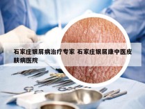 石家庄银屑病治疗专家 石家庄银屑康中医皮肤病医院