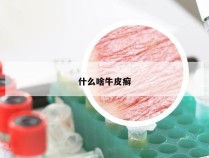什么啥牛皮癣