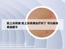 脸上白斑病 脸上白斑病治疗好了 可以画妆敷面膜不