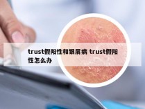 trust假阳性和银屑病 trust假阳性怎么办