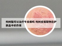 构树脂可以治疗牛皮癣吗 构树皮提取物在护肤品中的作用