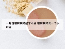 一月份银屑病又起了小点 银屑病只长一个小红点