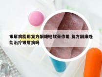银屑病能用复方酮康唑软膏作用 复方酮康唑能治疗银屑病吗