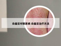 白扁豆对银屑病 白扁豆治疗方法