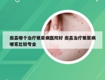 南昌哪个治疗银屑病医院好 南昌治疗银屑病哪家比较专业