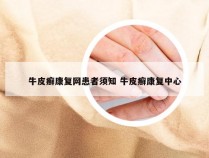 牛皮癣康复网患者须知 牛皮癣康复中心