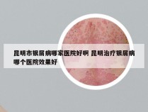 昆明市银屑病哪家医院好啊 昆明治疗银屑病哪个医院效果好