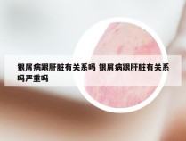 银屑病跟肝脏有关系吗 银屑病跟肝脏有关系吗严重吗