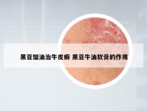黑豆馏油治牛皮癣 黑豆牛油软膏的作用