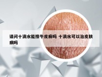 请问十滴水能擦牛皮癣吗 十滴水可以治皮肤病吗