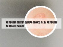 开封朝鲜皮肤科医院牛皮癣怎么治 开封朝鲜皮肤科医院简介