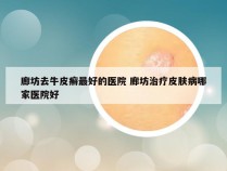 廊坊去牛皮癣最好的医院 廊坊治疗皮肤病哪家医院好