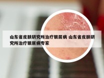 山东省皮肤研究所治疗银屑病 山东省皮肤研究所治疗银屑病专家