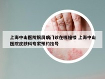 上海中山医院银屑病门诊在哪幢楼 上海中山医院皮肤科专家预约挂号